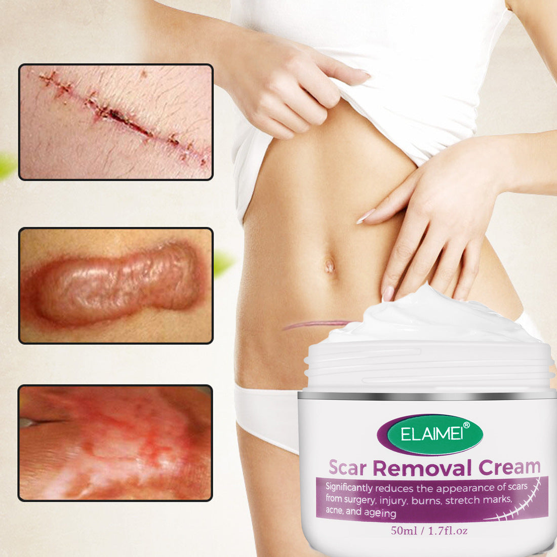 Skin Rebound Scarless Cream Scar